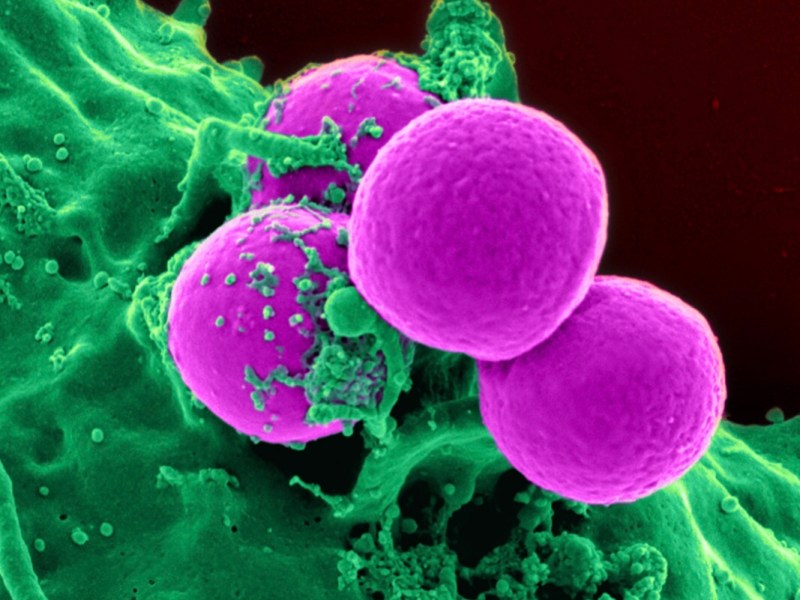 The Thing That Keeps Doctors Up At&nbsp;Night